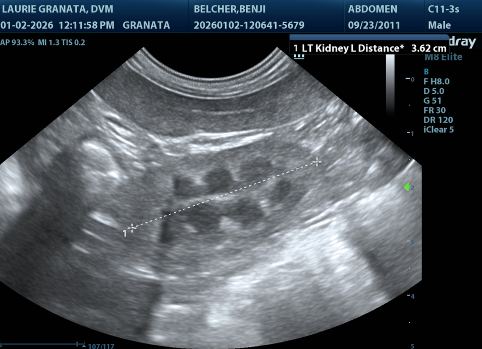 Kidney ultrasound image showing a kidney measurement